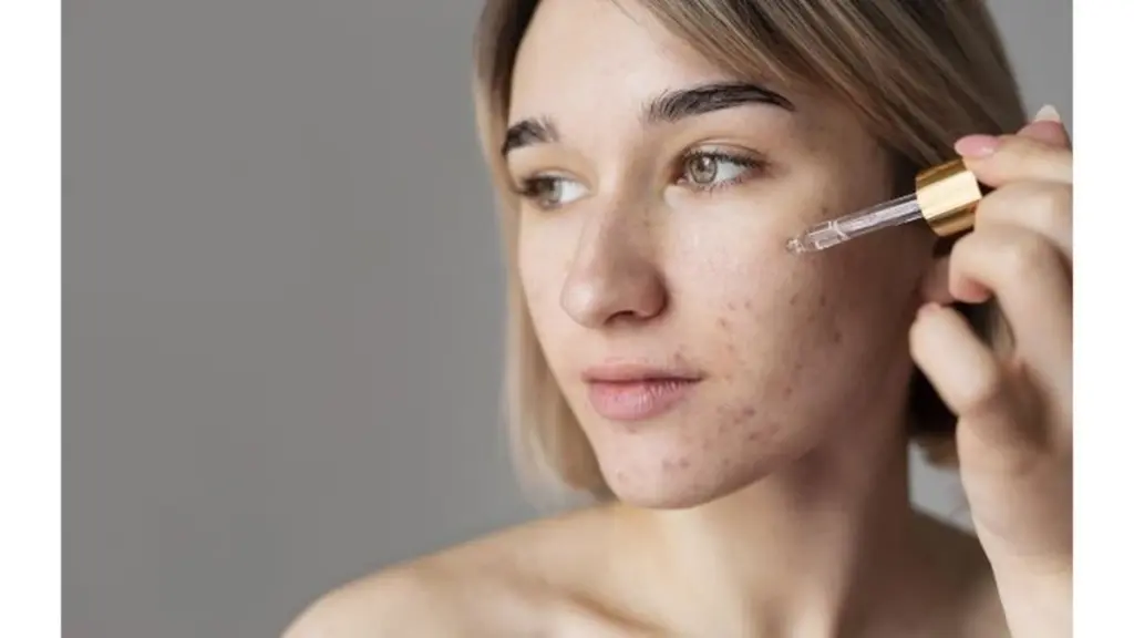 Dermatolog zapytał: „Kto ci tak poradził?” Po tym, jak opisałam swoje metody na pryszcze
